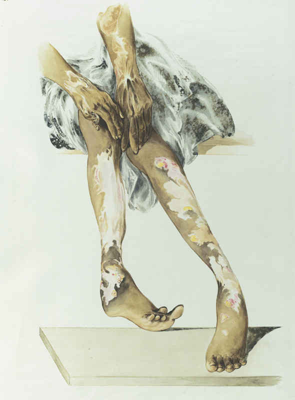 Alt-text: Watercolor drawing of legs Alt-text: Watercolor drawing of legs