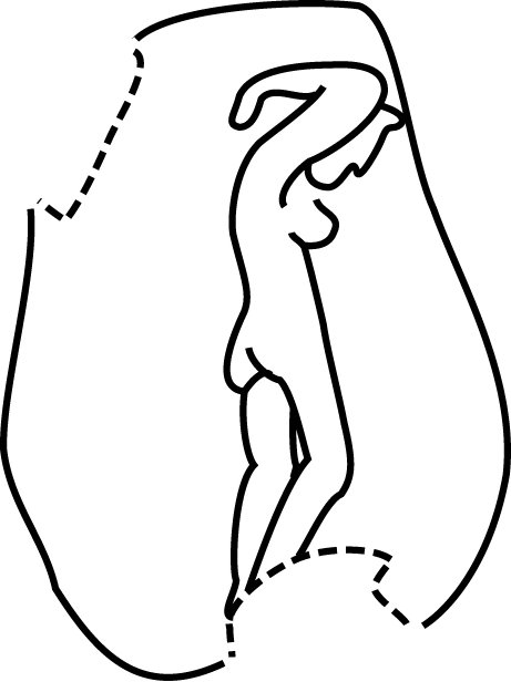 Photograph and drawing of a bulla from Kedesh showing Aphrodite represented as a naked figure bathing (fig. 7, no,Aph 1). Scale 4:1.