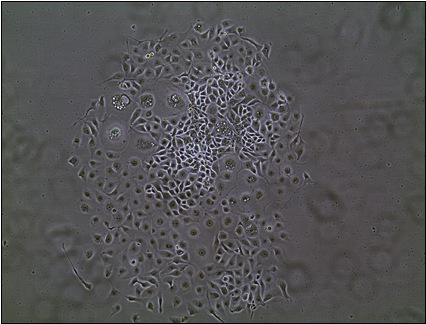 Micrograph of a heterogeneous stem cell colony isolated from human corneal cells at different stages of differentiation. The cell is likely to be at the centre of the colony where new cells reside. Further from the centre, the cells are older and larger and will eventually die as something new comes into being. Image reproduced with the permission of Dr Nick Di Girolamo, School of Medical Sciences, University of New South Wales, Sydney. Micrograph of a heterogeneous stem cell colony isolated from human corneal cells at different stages of differentiation. The cell is likely to be at the centre of the colony where new cells reside. Further from the centre, the cells are older and larger and will eventually die as something new comes into being. Image reproduced with the permission of Dr Nick Di Girolamo, School of Medical Sciences, University of New South Wales, Sydney.
