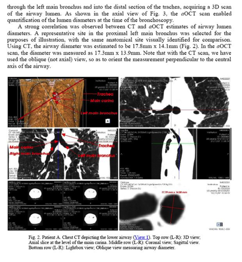 Figure 4—A PDF page containing an image with which the viewer can interact using the pre–installed ISP software and clicking on “View 1.” Figure 4—A PDF page containing an image with which the viewer can interact using the pre–installed ISP software and clicking on “View 1.”