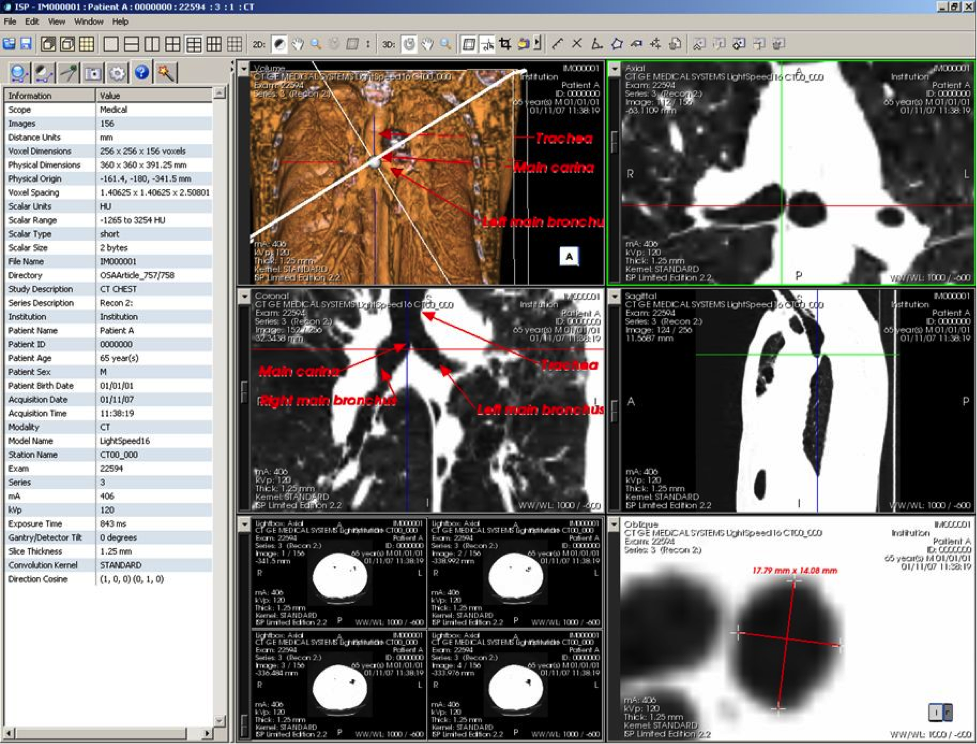 Figure 5—ISP interactive screen produced by clicking on “View 1” in image of reproduced PDF page shown in figure 4. Figure 5—ISP interactive screen produced by clicking on “View 1” in image of reproduced PDF page shown in figure 4.